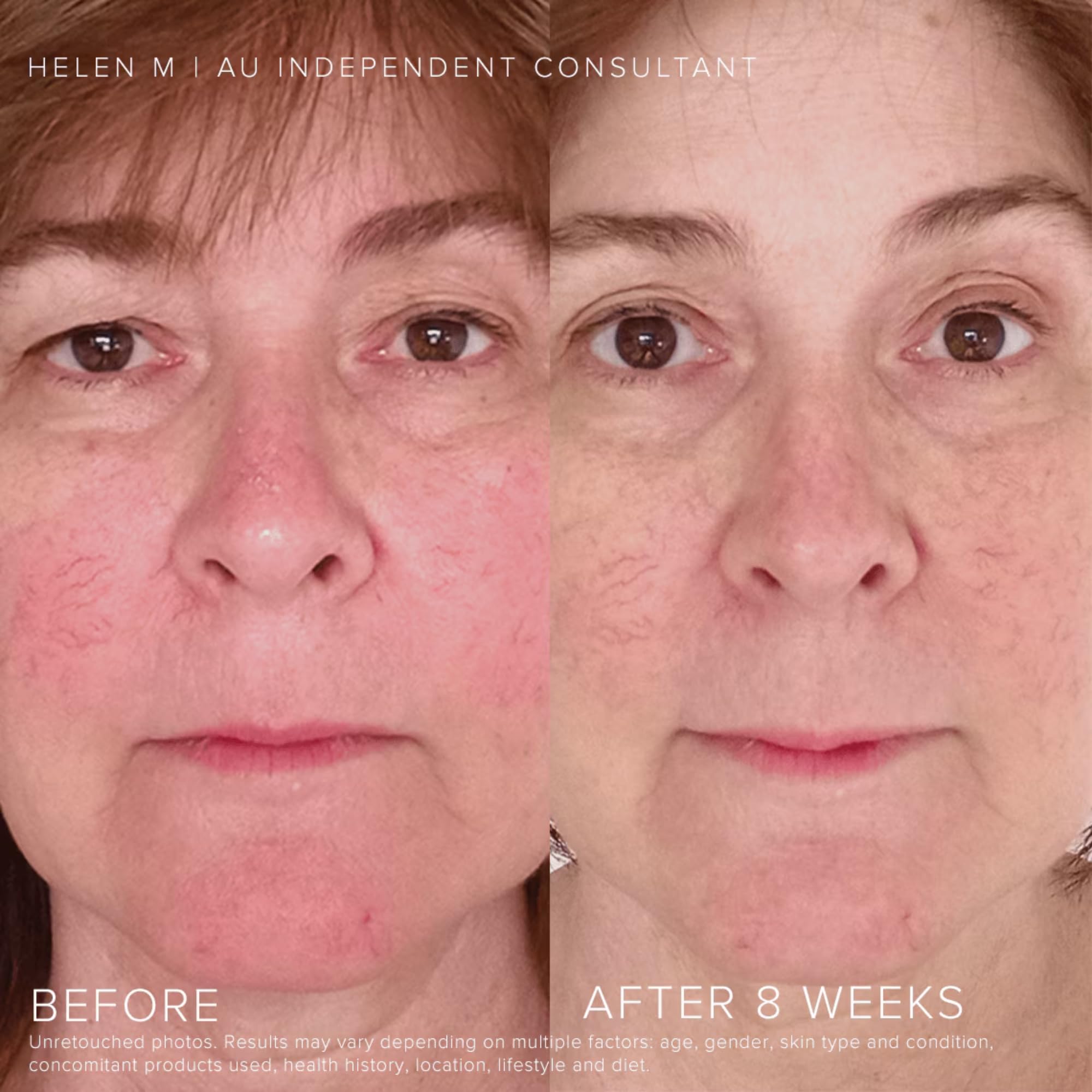 Rodan and Fields Soothe Regimen for Sensitive, Irritated Skin and Facial Redness - Image 3