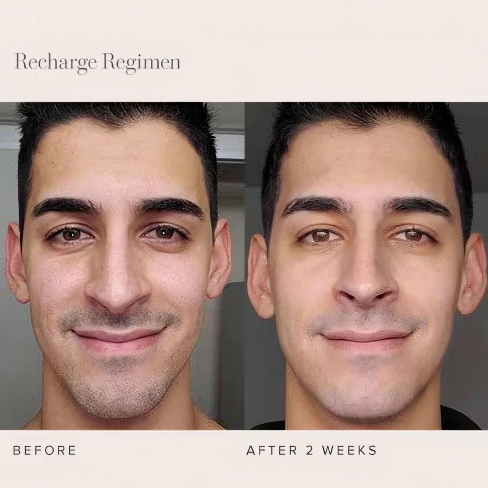 Rodan + Fields RECHARGE Regimen | Steps 1 to 3 | 3 in 1 Super Cleanser, Ultra Boost Moisturizing Treatment & Protect + Blur SPF 30 Sunscreen | Beauty & Skin Care Routine for Healthy Skin - Image 4