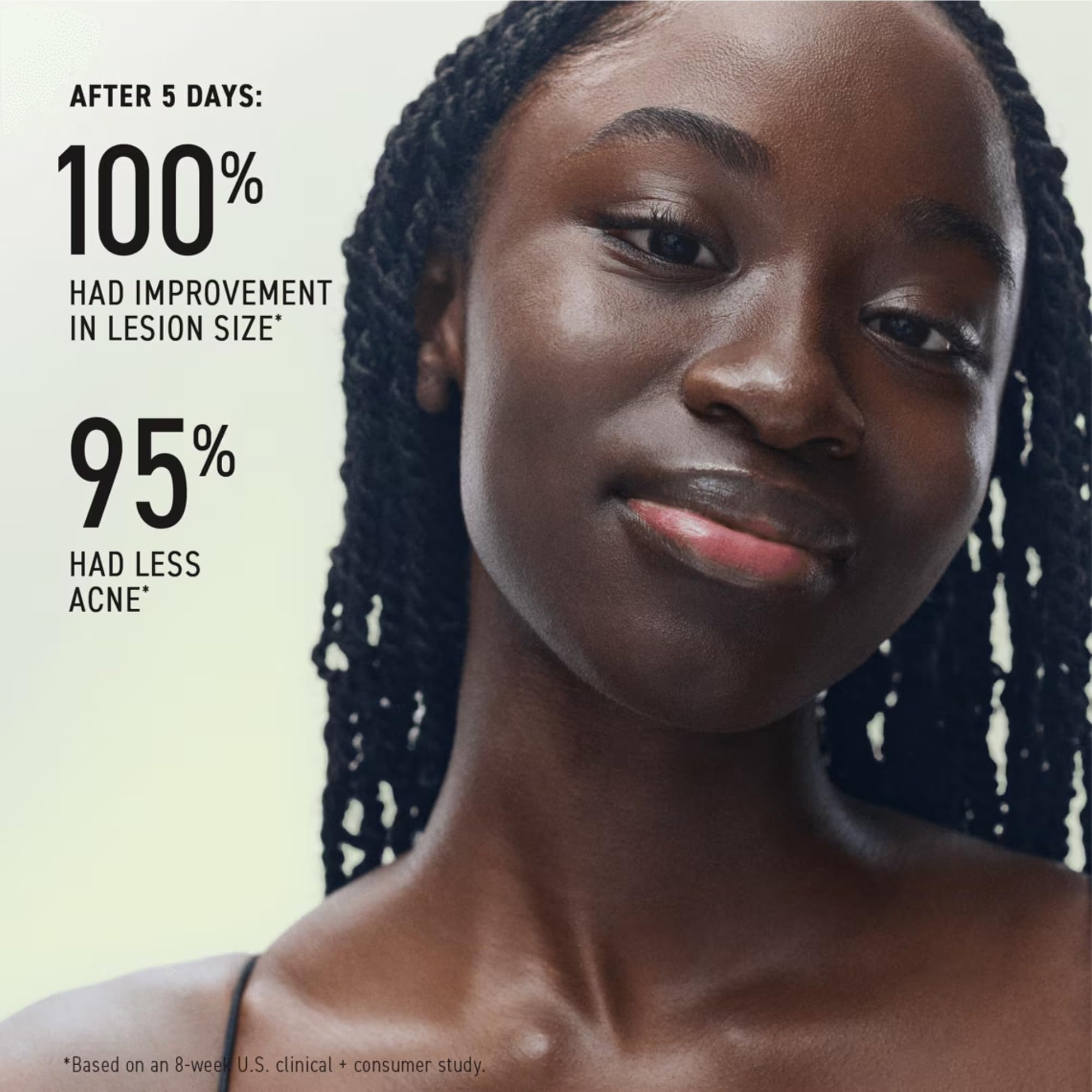 Rodan + Fields Spotless Regimen | Benzoyl Peroxide Face Wash for Sensitive Skin | Skincare Sets & Kits | Skin Care for Adults & Teens with Stubborn Acne | All Skin Types - Image 3